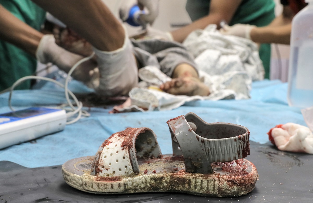Civil të vrarë dhe lënduar në Gaza nga sulmet e Izraelit. Foto nga Belal Khaled/AA